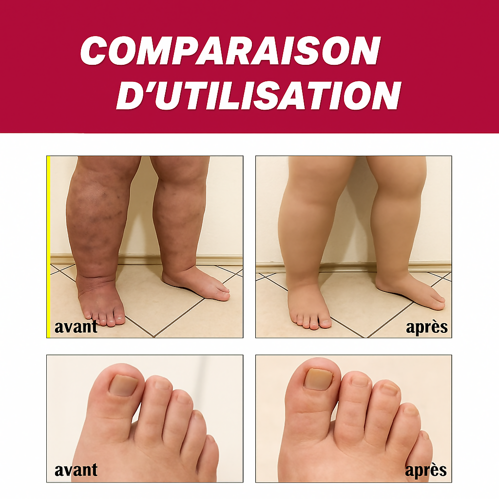 Comparaison