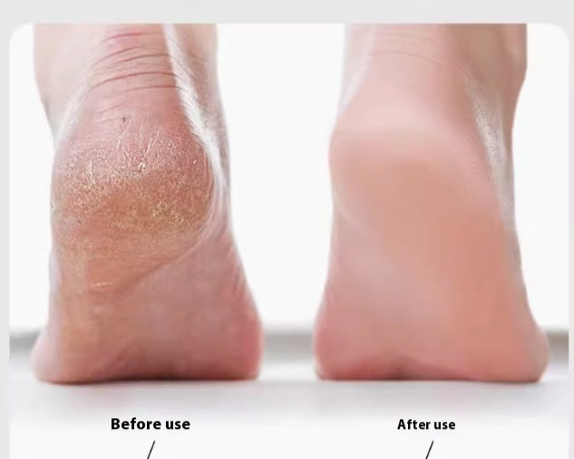 🌸 Appareil Électrique de Polissage pour Pieds – Peau Douce & Soignée Sans Effort ! 🌸