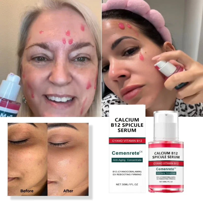 Sérum Anti-âge raffermissant les pores à épicule rose, Ampoule éclaircissante hydratante et lissante pour le visage, soin brillant coréen pour la peau