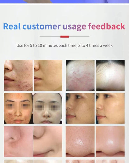 Pulvérisateur de brume hydratant pour la peau du visage, aérographe, nettoyage en profondeur du visage, injecteur d'oxygène, compresseur de brosse à Air sans fil