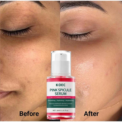 Sérum Anti-âge raffermissant les pores à épicule rose, Ampoule éclaircissante hydratante et lissante pour le visage, soin brillant coréen pour la peau