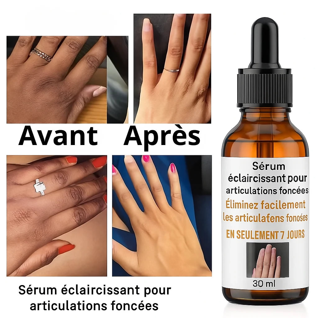 Avant_et_Apres