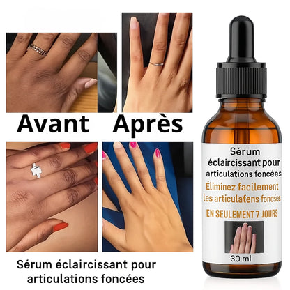 Avant_et_Apres